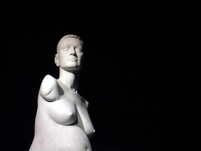 ALISON LAPPER, une leçon de vie !