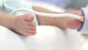 PRÉMATURITÉ: Les plus petits prématurés du monde se portent bien! – Pediatrics