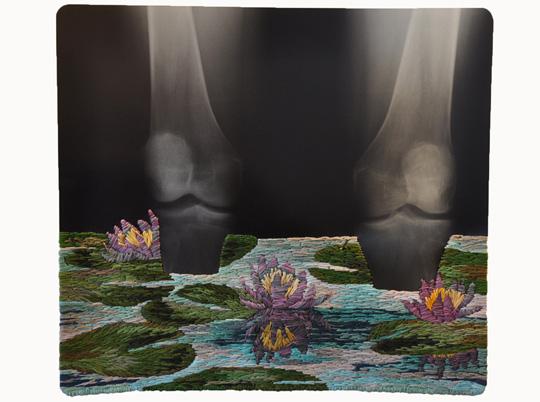 Embroidered X-rays by Matthew Cox