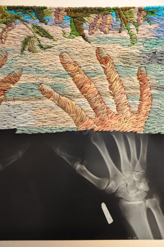 Embroidered X-rays by Matthew Cox