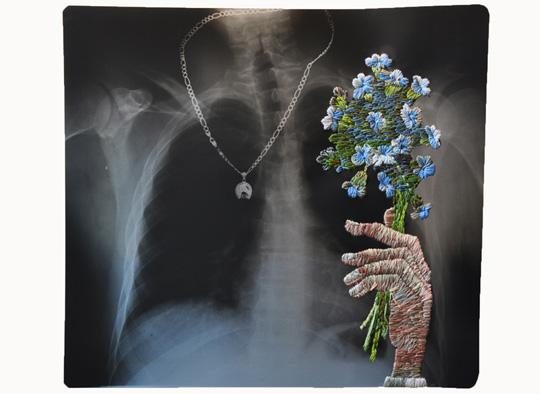 Embroidered X-rays by  Matthew Cox