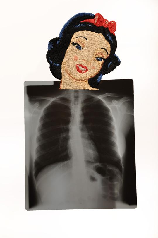 Embroidered X-rays by Matthew Cox