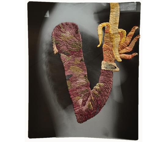 Embroidered X-rays by Matthew Cox