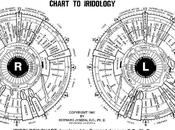 Diagnostic avec Iridology
