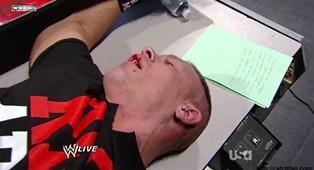 Après l'attaque de Kane John Cena est en sang