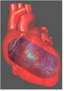 Du VIAGRA contre l’insuffisance cardiaque  – Circulation