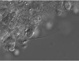 INFERTILITÉ: Du sperme généré à partir de cellules de testicules – Asian Journal of Andrology