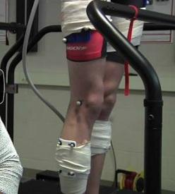 MOTRICITÉ: Mais pourquoi on court comme ça? – PNAS