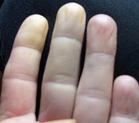 Blogger du bout des doigts