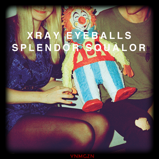 [MP3] Xray Eyeballs: « X »