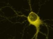 ALZHEIMER: Tau, protéine propage comme virus PLoS Neuron