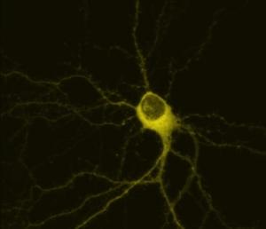 ALZHEIMER: Tau, la protéine qui se propage comme un virus – PLoS ONE et Neuron