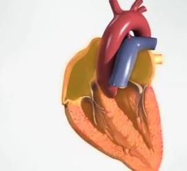 AVC: Les pacemakers peuvent détecter le risque – NEJM