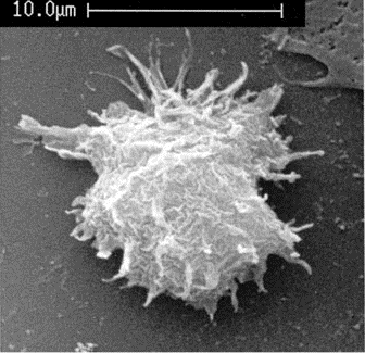 Acanthamoeba, voire pire
