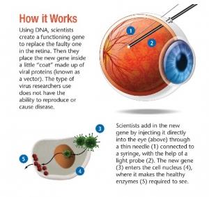 CÉCITÉ héréditaire: Une thérapie génique parvient à restaurer la vision  – Science Translational Medicine