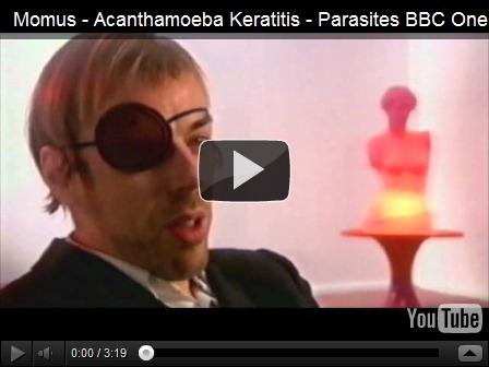 [Freaky Friday Parasite] Acanthamoeba