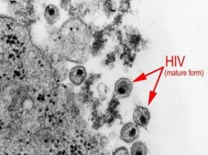 VIH: La protéine qui empêche le virus de se reproduire – Nature Immunology