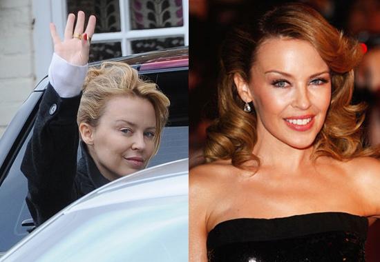 Les stars sans maquillage : Kylie Minogue 