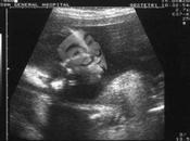 Echographie d'un Anonymous