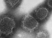 VIRUS SCHMALLENBERG: autorités écartent risque infectieux alimentaire pour l’Homme