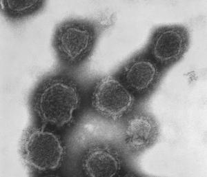 VIRUS SCHMALLENBERG: Les autorités écartent le risque infectieux et alimentaire pour l’Homme  – FSA et FLI