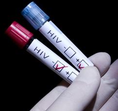 VIH: Les 8 maladies qui devraient inciter au dépistage – HIV in Europe Initiative