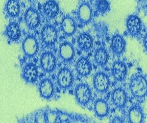 GRIPPE: Découverte d’un nouveau virus unique, chez des chauves-souris  – PNAS