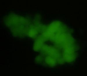 CELLULES SOUCHES: L’haleine stimule la production de cellules hépatiques – Journal of Breath Research