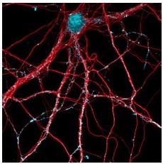 ALZHEIMER: Des anticorps spécifiques qui protègent les connexions des neurones  – Journal of Neuroscience