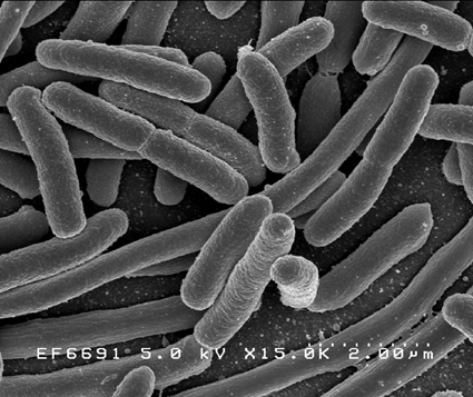 Escherischia coli