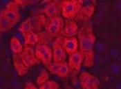Maladies HÉPATIQUES: Stimuler production d’hépatocytes pour éviter greffe Nature Medicine