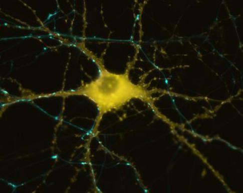 neurones, aran, dauman