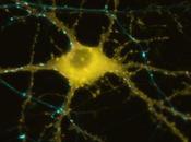 neurones l´acouphène