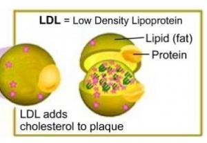 CANCER: Faible cholestérol LDL, risque de cancer plus tard dans la vie – ACC’s Annual Scientific Session