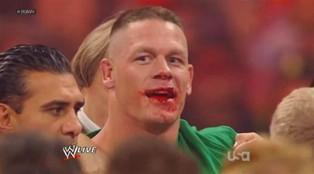 Après son altercation face à Brock Lesnar, John Cena saigne abondamment de la bouche 