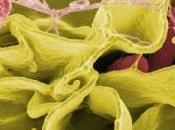 BACTÉRIES: Découverte salmonelles hypervirulentes PLoS Pathogens