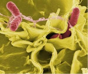 BACTÉRIES: Découverte de salmonelles hypervirulentes  – PLoS Pathogens
