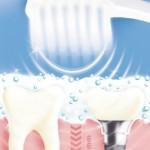 Nouvelle technologie: La brosse à dents à ultrason