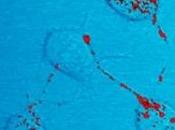 Maladie VACHE FOLLE: Nouveau nouveau type prions identifié Etats-Unis Nature Blog