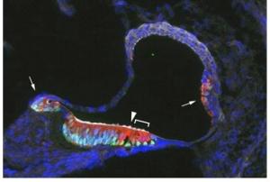 SURDITÉ: La thérapie génique récrée des cellules ciliées sensorielles – Journal of Neuroscience