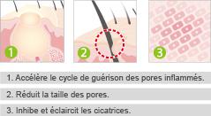 Bout's killer : Acne Clear de Ünt