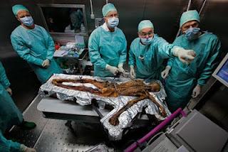 La malédiction de la Momie Otzi