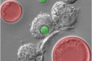 CRYPTOCOCCOSE et VIH: Cibler les cellules titan qui protègent Cryptococcus – Eukaryotic Cell