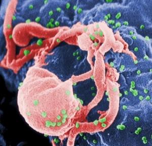 VIH: Des scientifiques du NIH identifient une nouvelle protéine qui inhibe le virus – PNAS-NIH
