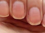 Quelle forme pour quels ongles?