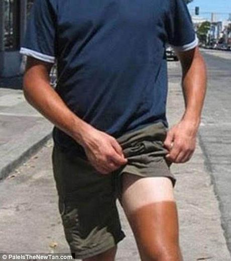 Top 10 des bronzages les plus ratés