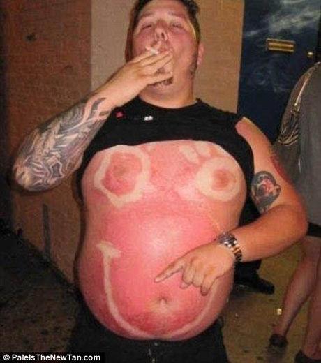 Top 10 des bronzages les plus ratés