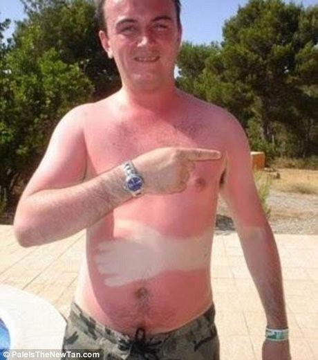 Top 10 des bronzages les plus ratés