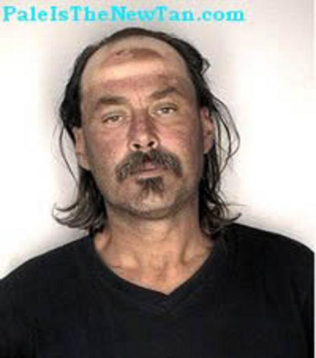 Top 10 des bronzages les plus ratés