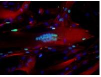 MÉDECINE RÉGÉNÉRATIVE: Les cellules souches sont-elles éternelles? – Nature Communication